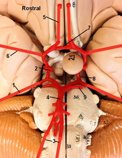 Circle of Willis 2