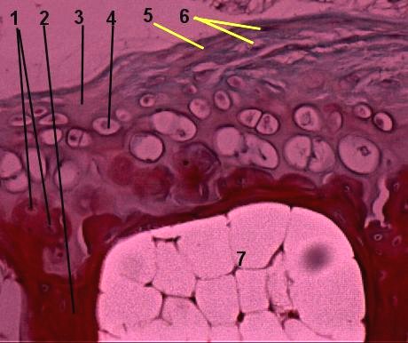 Fibrocartilage hard