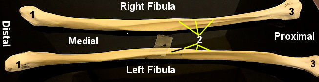 Tibia Model