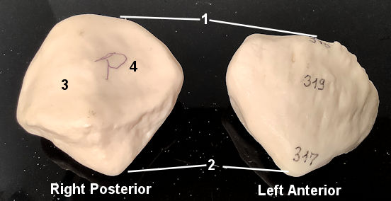 patella