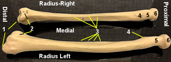 radius