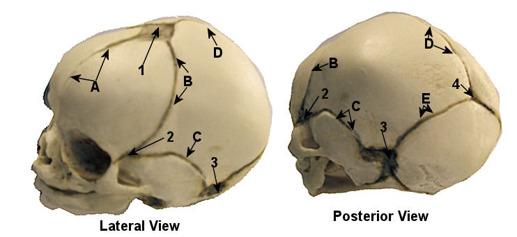 Fetal Skull