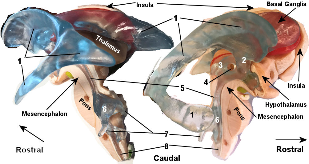 Ventricle Model